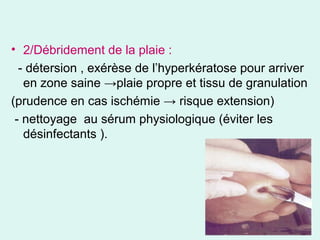 • 2/Débridement de la plaie :
- détersion , exérèse de l’hyperkératose pour arriver
en zone saine →plaie propre et tissu de granulation
(prudence en cas ischémie → risque extension)
- nettoyage au sérum physiologique (éviter les
désinfectants ).
 