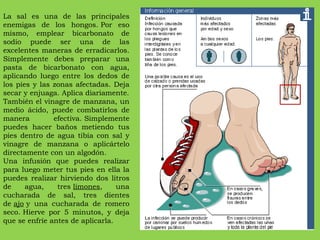 La sal es una de las principales enemigas de los hongos. Por eso mismo, emplear bicarbonato de sodio puede ser una de las excelentes maneras de erradicarlos. Simplemente debes preparar una pasta de bicarbonato con agua, aplicando luego entre los dedos de los pies y las zonas afectadas. Deja secar y enjuaga. Aplica diariamente. También el vinagre de manzana, un medio ácido, puede combatirlos de manera efectiva. Simplemente puedes hacer baños metiendo tus pies dentro de agua tibia con sal y vinagre de manzana o aplicártelo directamente con un algodón. Una infusión que puedes realizar para luego meter tus pies en ella la puedes realizar hirviendo dos litros de agua, tres  limones , una cucharada de sal, tres dientes de  ajo  y una cucharada de romero seco. Hierve por 5 minutos, y deja que se enfríe antes de aplicarla. 