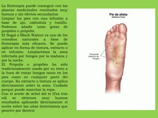 La fitoterapia puede conseguir con las plantas medicinales resultados muy buenos y sin efectos secundarios Limpiar los pies con una infusión a base de ajo, caléndula y tomillo. Podemos añadir unas gotas de propóleo o própolis. El Nogal o Black Walnut es uno de los remedios naturales a base de fitoterapia más eficaces. Se puede aplicar en forma de tintura, extracto o en infusión. Limpiaremos la zona infectada por hongos por la mañana y por la noche. El Própolis o propóleo ha sido tradicionalmente usado por su éxito a la hora de tratar hongos tanto en los pies como en cualquier parte del cuerpo. Su extracto o tintura se aplica directamente sobre la zona. Cuidado porque puede manchar la ropa. Con el aceite de árbol del te (Tea tree oil) se obtienen muy buenos resultados aplicando directamente el aceite sobre las uñas (intentamos que penetre por dentro) 
