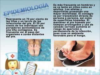 Representa un 7700 ppoorr cciieennttoo ddee 
llaass ttiiññaass yy uunn tteerrcciioo ddee llaass 
iinnffeecccciioonneess ddeell ppiiee.. EEll 2200 ppoorr 
cciieennttoo ddee llooss iinnddiivviidduuooss ssoonn 
ppoorrttaaddoorreess aassiinnttoommááttiiccooss ddee 
uunnaa ttiiññaa ccoonnttaaggiioossaa.. EEss 
ffrreeccuueennttee vveerr eell ppaassoo ddeell 
oorrggaanniissmmoo aa zzoonnaass ddiissttaanntteess 
ddeell ppiiee.. 
EEss mmááss ffrreeccuueennttee eenn hhoommbbrreess yy 
ssee vvee ttaannttoo eenn nniiññooss ccoommoo eenn 
aadduullttooss.. LLooss aattlleettaass yy 
ddeeppoorrttiissttaass pprreesseennttaann uunnaa 
mmaayyoorr mmoorrbbiilliiddaadd.. EEll ccoonnttaaggiioo 
eess ppoorr ttrraannssmmiissiióónn ddiirreeccttaa ddee 
ppeerrssoonnaa aa ppeerrssoonnaa,, aassíí ccoommoo 
ddee ssuuppeerrffiicciieess hhúúmmeeddaass.. EEll 
mmaanntteenneerr eell ppiiee hhúúmmeeddoo ppoorr 
ttiieemmppooss pprroolloonnggaaddooss yy uussoo ddee 
ccaallzzaaddoo cceerrrraaddoo aauummeennttaa eell 
rriieessggoo ddee aappaarriicciióónn oo 
ppeerrmmaanneenncciiaa ddee llaa iinnffeecccciióónn,, 
ppuueess ccrreeaa uunn aammbbiieennttee 
ffaavvoorraabbllee ppaarraa eell hhoonnggoo.. 
 