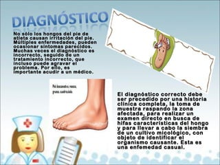 No sólo los hhoonnggooss ddeell ppiiee ddee 
aattlleettaa ccaauussaann iirrrriittaacciióónn ddeell ppiiee.. 
MMúúllttiipplleess eennffeerrmmeeddaaddeess,, ppuueeddeenn 
ooccaassiioonnaarr ssíínnttoommaass ppaarreecciiddooss.. 
MMuucchhaass vveecceess eell ddiiaaggnnóóssttiiccoo eess 
iinnccoorrrreeccttoo,, sseegguuiiddoo ddee uunn 
ttrraattaammiieennttoo iinnccoorrrreeccttoo,, qquuee 
iinncclluussoo ppuueeddee aaggrraavvaarr eell 
pprroobblleemmaa.. PPoorr eelllloo,, eess 
iimmppoorrttaannttee aaccuuddiirr aa uunn mmééddiiccoo.. 
EEll ddiiaaggnnóóssttiiccoo ccoorrrreeccttoo ddeebbee 
sseerr pprreecceeddiiddoo ppoorr uunnaa hhiissttoorriiaa 
ccllíínniiccaa ccoommpplleettaa,, llaa ttoommaa ddee 
mmuueessttrraa rraassppaannddoo llaa zzoonnaa 
aaffeeccttaaddaa,, ppaarraa rreeaalliizzaarr uunn 
eexxaammeenn ddiirreeccttoo eenn bbuussccaa ddee 
hhiiffaass ccaarraacctteerrííssttiiccaass ddeell hhoonnggoo 
yy ppaarraa lllleevvaarr aa ccaabboo llaa ssiieemmbbrraa 
ddee uunn ccuullttiivvoo mmiiccoollóóggiiccoo,, ccoonn 
oobbjjeettoo ddee iiddeennttiiffiiccaarr eell 
oorrggaanniissmmoo ccaauussaannttee.. EEssttaa eess 
uunnaa eennffeemmeeddaadd ccaassuuaall.. 
 