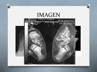 IMAGEN
 