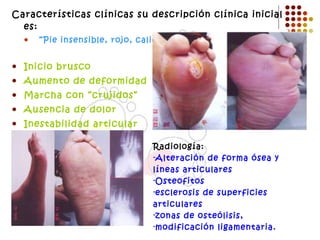 Características clínicas su descripción clínica inicial es: “ Pie insensible, rojo, caliente y tumefacto” Inicio brusco Aumento de deformidad Marcha con “crujidos” Ausencia de dolor Inestabilidad articular Alteración funcional Radiología: Alteración de forma ósea y líneas articulares Osteofitos esclerosis de superficies articulares zonas de osteólisis, modificación ligamentaria. 