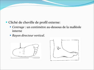 Cliché de cheville de profil externe: Centrage  : un centimètre au-dessous de la malléole interne Rayon directeur vertical . 