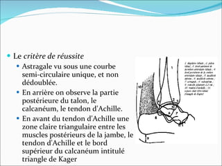 Le  critère de réussite   Astragale vu sous une courbe semi-circulaire unique, et non dédoublée. En arrière on observe la partie postérieure du talon, le calcanéum, le tendon d'Achille.  En avant du tendon d'Achille une zone claire triangulaire entre les muscles postérieurs de la jambe, le tendon d'Achille et le bord supérieur du calcanéum intitulé triangle de Kager  
