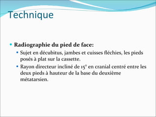Radiographie du pied de face: Sujet en décubitus, jambes et cuisses ﬂéchies, les pieds posés à plat sur la cassette.  Rayon directeur incliné de 15° en cranial centré entre les deux pieds à hauteur de la base du deuxième métatarsien. Technique 