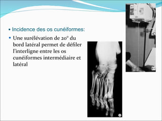 Une surélévation de 20° du bord latéral permet de déﬁler l’interligne entre les os cunéiformes intermédiaire et latéral •  Incidence des os cunéiformes: 