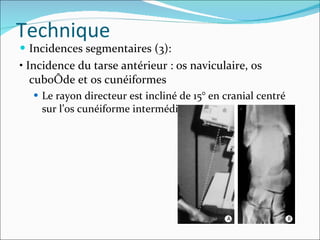Incidences segmentaires (3): • Incidence du tarse antérieur : os naviculaire, os cuboïde et os cunéiformes Le rayon directeur est incliné de 15° en cranial centré sur l’os cunéiforme intermédiaire Technique 