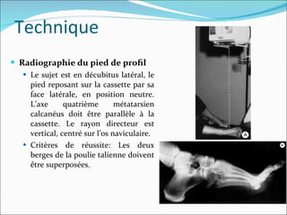 Radiographie du pied de proﬁl Le sujet est en décubitus latéral, le pied reposant sur la cassette par sa face latérale, en position neutre. L’axe quatrième métatarsien calcanéus doit être parallèle à la cassette. Le rayon directeur est vertical, centré sur l’os naviculaire. Critères de réussite: Les deux berges de la poulie talienne doivent être superposées. Technique 