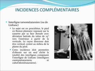 Interligne tarsométatarsien (ou de Lisfranc) Le sujet est en procubitus, le pied en ﬂexion plantaire reposant sur la cassette par sa face dorsale avec déviation latérale du talon de 25° vers l’extérieur à partir de la verticale. Le rayon directeur doit être vertical, centré au milieu de la plante du pied. Cette incidence doit permettre d’obtenir sur un seul cliché la totalité des interlignes composant l’interligne de Lisfranc (interlignes cunéométatarsiens et cuboïdométatarsiens). INCIDENCES COMPLÉMENTAIRES 