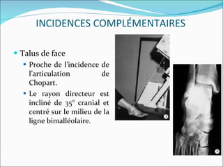 Talus de face  Proche de l’incidence de l’articulation de Chopart.  Le rayon directeur est incliné de 35° cranial et centré sur le milieu de la ligne bimalléolaire. INCIDENCES COMPLÉMENTAIRES 
