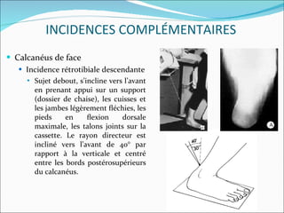 Calcanéus de face Incidence rétrotibiale descendante Sujet debout, s’incline vers l’avant en prenant appui sur un support (dossier de chaise), les cuisses et les jambes légèrement ﬂéchies, les pieds en ﬂexion dorsale maximale, les talons joints sur la cassette. Le rayon directeur est incliné vers l’avant de 40° par rapport à la verticale et centré entre les bords postérosupérieurs du calcanéus. INCIDENCES COMPLÉMENTAIRES 