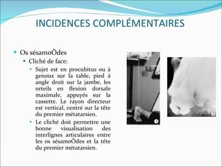Os sésamoïdes Cliché de face: Sujet est en procubitus ou à genoux sur la table, pied à angle droit sur la jambe, les orteils en ﬂexion dorsale maximale, appuyés sur la cassette. Le rayon directeur est vertical, centré sur la tête du premier métatarsien. Le cliché doit permettre une bonne visualisation des interlignes articulaires entre les os sésamoïdes et la tête du premier métatarsien. INCIDENCES COMPLÉMENTAIRES 