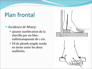 Plan frontal Incidence de Meary:  ajouter   surélévation de la cheville par un bloc. radiotransparant de 1 cm. Fil de plomb souple tendu en étrier entre les deux malléoles. 