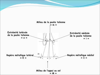Extrémité latérale  de la poulie talienne « e » Extrémité médiale  de la poulie talienne « i » Repère métallique latéral « E » Repère métallique médial « I » Milieu de la poulie talienne « m » Milieu de l’appui au sol « M » 