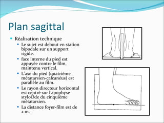 Réalisation technique Le sujet est debout en station bipodale sur un support rigide. face interne du pied est appuyée contre le film, maintenu vertical. L’axe du pied (quatrième métatarsien-calcanéus) est parallèle au film.  Le rayon directeur horizontal est centré sur l’apophyse styloïde du cinquième métatarsien. La distance foyer-film est de 2 m. Plan sagittal 