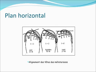 Plan horizontal Alignement des têtes des métatarsiens  