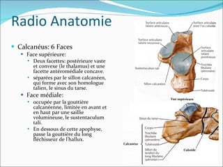 Calcanéus: 6 Faces Face supérieure:  Deux facettes: postérieure vaste et convexe (le thalamus) et une facette antéromédiale concave. séparées par le sillon calcanéen, qui forme avec son homologue talien, le sinus du tarse. Face médiale:  occupée par la gouttière calcanéenne, limitée en avant et en haut par une saillie volumineuse, le sustentaculum tali.  En dessous de cette apophyse, passe la gouttière du long fléchisseur de l’hallux. Radio Anatomie 