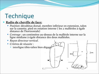 Radio de cheville de face: Position : décubitus dorsal, membre inférieur en extension, talon sur la cassette, pied en rotation interne ( les 2 malléoles à égale distance de l’horizontale) Centrage   :   un centimètre au-dessus de la malléole interne sur la ligne médiane à égale distance des deux malléoles.  Rayon directeur vertical . Critères de réussite  :  interligne tibio-talien bien dégagé.  Technique 