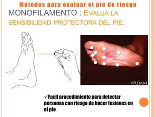 MONOFILAMENTO : EVALUA LA
SENSIBILIDAD PROTECTORA DEL PIE.
Facil procedimiento para detectar
personas con riesgo de hacer lesiones en
el pie
●
●
●
● ●
●
●
●
●
●
●