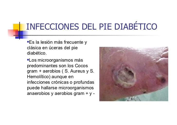 Pie diabetico Pie diabetico