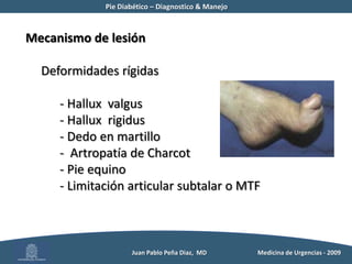  Edad avanzadaLocalesNeuropatía periférica