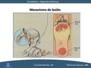 AP de ulceras o amputación