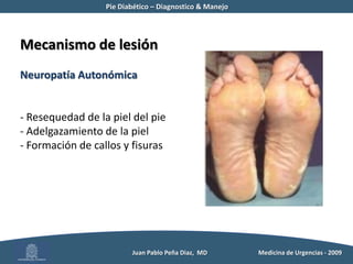  Presiones locales elevadas