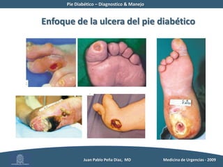 Pie Diabético – Diagnostico & Manejo	          Juan Pablo Peña Diaz,  MD 	Medicina de Urgencias - 2009