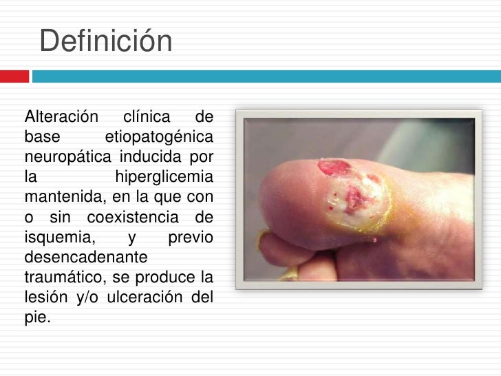 Infecciones Del Pie Diabetico Una Mirada Clinica Y Microbiologica Images