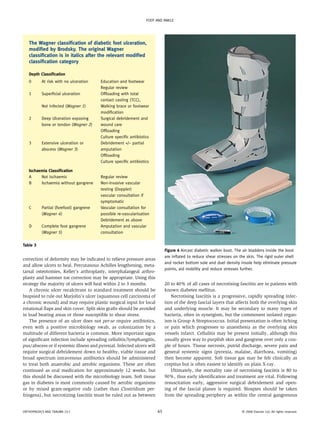 FOOT AND ANKLE




   The Wagner classification of diabetic foot ulceration,
   modified by Brodsky. The original Wagner
   classification is in italics after the relevant modified
   classification category

   Depth Classification
   0       At risk with no ulceration    Education and footwear
                                         Regular review
   1       Superficial ulceration        Offloading with total
                                         contact casting (TCC),
           Not infected (Wagner 1)       Walking brace or footwear
                                         modification
   2       Deep Ulceration exposing      Surgical debridement and
           bone or tendon (Wagner 2)     wound care
                                         Offloading
                                         Culture specific antibiotics
   3       Extensive ulceration or       Debridement +/− partial
           abscess (Wagner 3)            amputation
                                         Offloading
                                         Culture specific antibiotics

   Ischaemia Classification
   A     Not ischaemic                   Regular review
   B     Ischaemia without gangrene      Non-invasive vascular
                                         testing (Doppler)
                                         vascular consultation if
                                         symptomatic
   C       Partial (forefoot) gangrene   Vascular consultation for
           (Wagner 4)                    possible re-vascularisation
                                         Debridement as above
   D       Complete foot gangrene        Amputation and vascular
           (Wagner 5)                    consultation

Table 3
                                                                             Figure 4 Aircast diabetic walker boot. The air bladders inside the boot
                                                                             are inflated to reduce shear stresses on the skin. The rigid outer shell
correction of deformity may be indicated to relieve pressure areas
                                                                             and rocker bottom sole and duel density insole help eliminate pressure
and allow ulcers to heal. Percutanous Achilles lengthening, meta-
                                                                             points, aid mobility and reduce stresses further.
tarsal osteotomies, Keller’s arthroplasty, interphalangeal arthro-
plasty and hammer toe correction may be appropriate. Using this
strategy the majority of ulcers will heal within 2 to 3 months.              20 to 40% of all cases of necrotising fasciitis are in patients with
    A chronic ulcer recalcitrant to standard treatment should be             known diabetes mellitus.
biopsied to rule out Marjolin’s ulcer (squamous cell carcinoma of               Necrotising fasciitis is a progressive, rapidly spreading infec-
a chronic wound) and may require plastic surgical input for local            tion of the deep fascial layers that affects both the overlying skin
rotational flaps and skin cover. Split skin grafts should be avoided         and underlying muscle. It may be secondary to many types of
in load bearing areas or those susceptible to shear stress.                  bacteria, often in synergism, but the commonest isolated organ-
    The presence of an ulcer does not per-se require antibiotics,            ism is Group A Streptococcus. Initial presentation is often itching
even with a positive microbiology swab, as colonization by a                 or pain which progresses to anaesthesia as the overlying skin
multitude of different bacteria is common. More important signs              vessels infarct. Cellulitis may be present initially, although this
of significant infection include spreading cellulitis/lymphangitis,          usually gives way to purplish skin and gangrene over only a cou-
pus/abscess or if systemic illness and pyrexial. Infected ulcers will        ple of hours. Tissue necrosis, putrid discharge, severe pain and
require surgical debridement down to healthy, viable tissue and              general systemic signs (pyrexia, malaise, diarrhoea, vomiting)
broad spectrum intravenous antibiotics should be administered                then become apparent. Soft tissue gas may be felt clinically as
to treat both anaerobic and aerobic organisms. These are often               crepitus but is often easiest to identify on plain X-ray.
continued as oral medication for approximately 12 weeks, but                    Ultimately, the mortality rate of necrotising fasciitis is 80 to
this should be discussed with the microbiology team. Soft tissue             90%, thus early identification and treatment are vital. Following
gas in diabetes is most commonly caused by aerobic organisms                 resuscitation early, aggressive surgical debridement and open-
or by mixed gram-negative rods (rather than Clostridium per-                 ing of the fascial planes is required. Biospies should be taken
fringens), but necrotizing fasciitis must be ruled out as between            from the spreading periphery as within the central gangrenous


ORTHOPAEDICS AND TRAUMA 23:1                                            65                                             © 2008 Elsevier Ltd. All rights reserved.
 