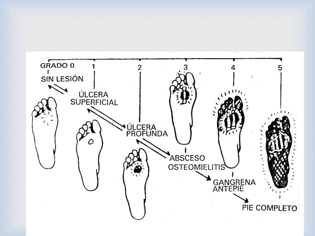 Pie diabético en México 2014