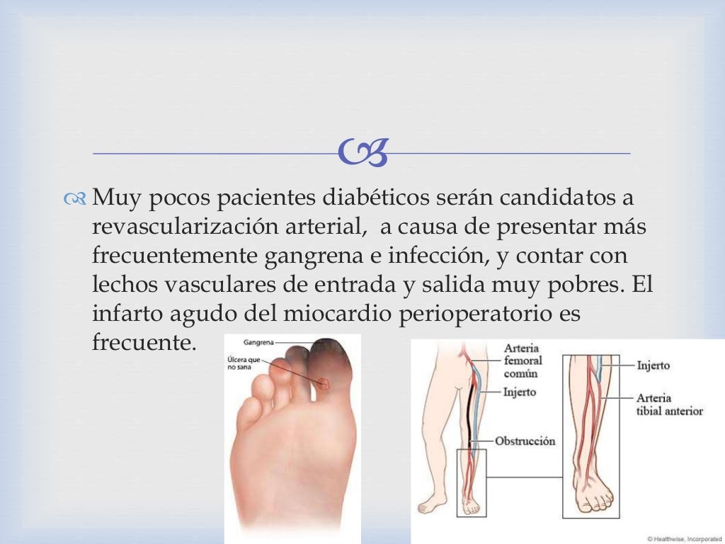 Pie diabético en México 2014