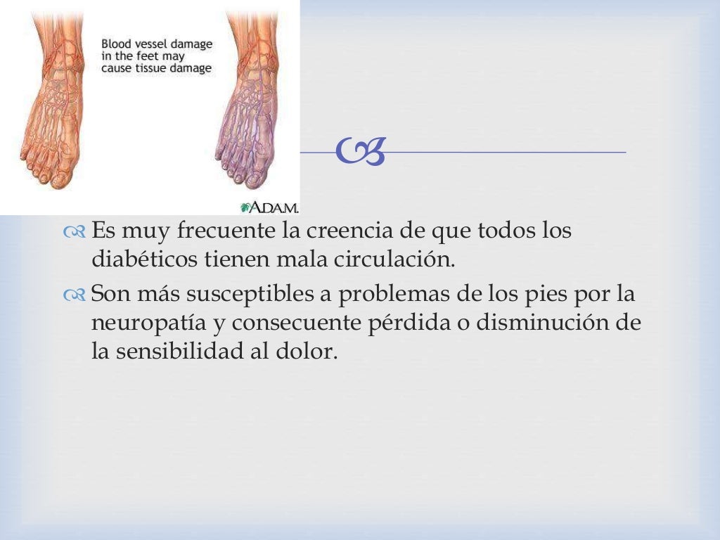 Pie diabético en México 2014