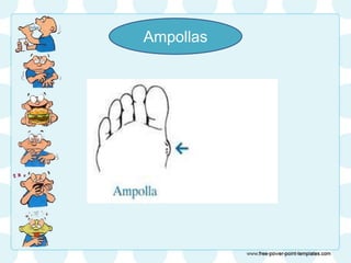 Ampollas
 