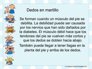Se forman cuando un músculo del pie se
debilita. La debilidad puede ser causada
por los nervios que han sido dañados por
la diabetes. El músculo débil hace que los
tendones del pie se vuelvan más cortos y
que los dedos se doblen hacia abajo.
También puede llegar a tener llagas en la
planta del pie y arriba de los dedos.
Dedos en martillo
 