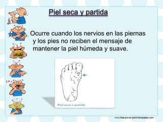 Piel seca y partida
Ocurre cuando los nervios en las piernas
y los pies no reciben el mensaje de
mantener la piel húmeda y suave.
 