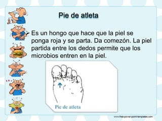 Pie de atleta
 Es un hongo que hace que la piel se
ponga roja y se parta. Da comezón. La piel
partida entre los dedos permite que los
microbios entren en la piel.
 