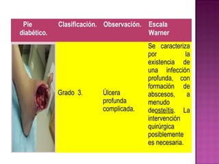 Pie
diabético.
Clasificación. Observación. Escala
Warner
Grado 3. Úlcera
profunda
complicada.
Se caracteriza
por la
existencia de
una infección
profunda, con
formación de
abscesos, a
menudo
deosteítis. La
intervención
quirúrgica
posiblemente
es necesaria.
 