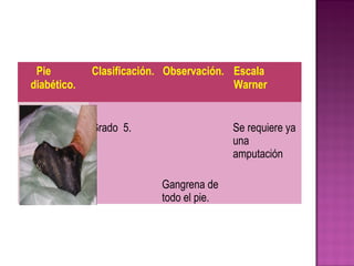 Pie
diabético.
Clasificación. Observación. Escala
Warner
Grado 5.
Gangrena de
todo el pie.
Se requiere ya
una
amputación
 