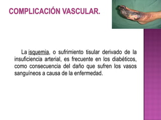 La isquemia, o sufrimiento tisular derivado de la
insuficiencia arterial, es frecuente en los diabéticos,
como consecuencia del daño que sufren los vasos
sanguíneos a causa de la enfermedad.
 
