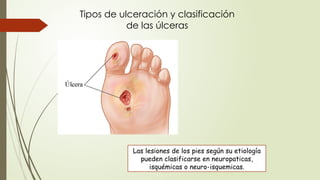 Tipos de ulceración y clasificación
de las úlceras
Las lesiones de los pies según su etiología
pueden clasificarse en neuropaticas,
isquémicas o neuro-isquemicas.
 
