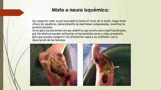 Se comporta como un pie neuropático hasta el inicio de la lesión, luego tiene
clínica de isquémico. Generalmente se mantienen compensados, mientras no
existan lesiones.
Sirve para los pacientes con pie diabético que exista esta clasificación para
que los médicos puedan enfocarse en las posibles curas y cómo prevenirlo,
para que puedan compartir los diferentes casos y no confundir con la
descripción de las lesiones.
Mixto o neuro isquémico:
 