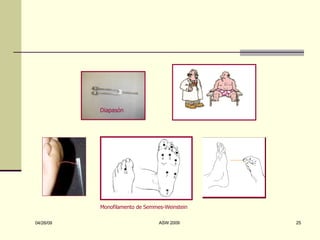 Monofilamento de Semmes-Weinstein Diapasón 