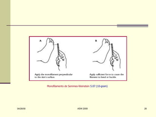 Monofilamento de Semmes-Weinstein  5.07 (10-gram) 