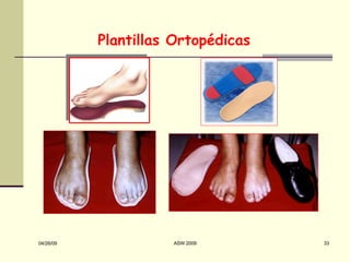 Plantillas Ortopédicas 