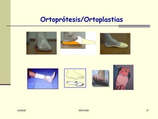 Ortoprótesis/Ortoplastias 