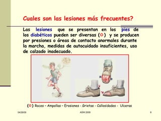 Las  lesiones   que  se  presentan  en  los  pies   de  los  diabéticos  pueden ser diversas (  )  y se producen por presiones o áreas de contacto anormales durante la marcha, medidas de autocuidado insuficientes, uso de calzado inadecuado. Cuales son las lesiones más frecuentes? (  )  Roces – Ampollas – Erosiones - Grietas - Callosidades -  Ulceras 