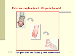 Evite las complicaciones!. Ud puede hacerlo! Sus pies valen una fortuna y debe conservarlos! 