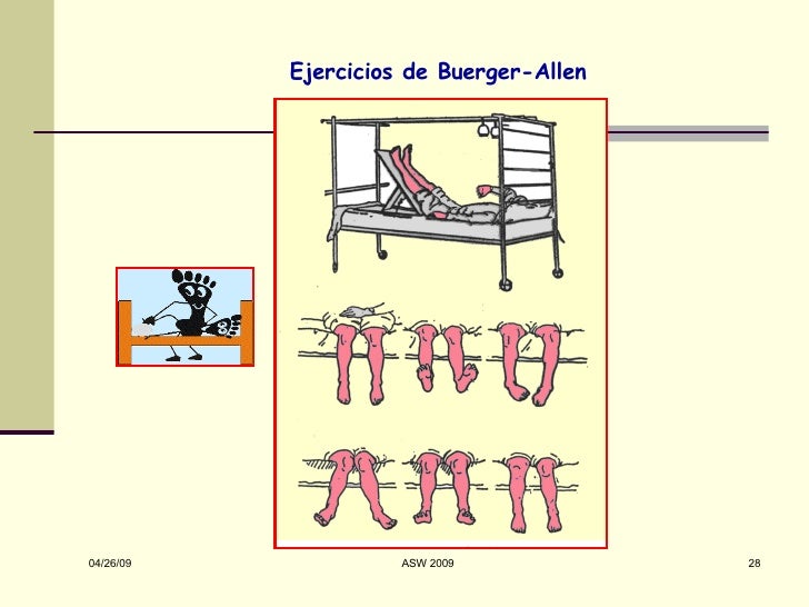 Pie Diabetico: Aspectos Clinicos y Preventivos Pie Diabetico: Aspectos Clinicos y Preventivos